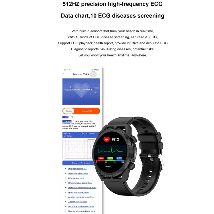 ET310 1.39インチ IPS画面 IP67 防水 シリコンバンド スマートウォッチ、体温モニタリング / ECG 対応、ET310