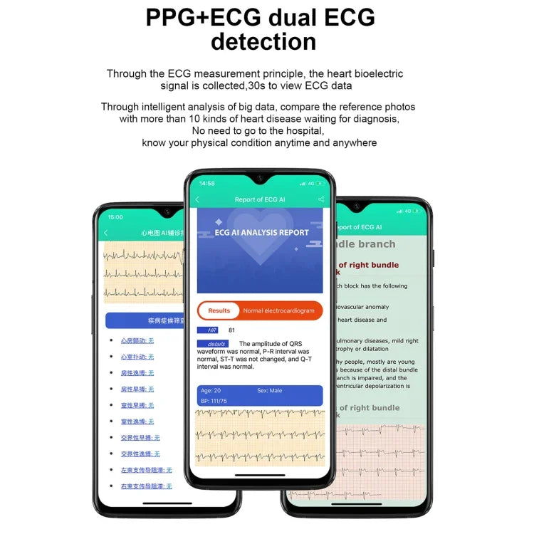 E86 1.7インチ TFTカラー画面 IP68防水 スマートウォッチ、血中酸素モニタリング / 体温モニタリング / AI医療診断対応、スタイル：スチールストラップ、スチールストラップ（ブラック）