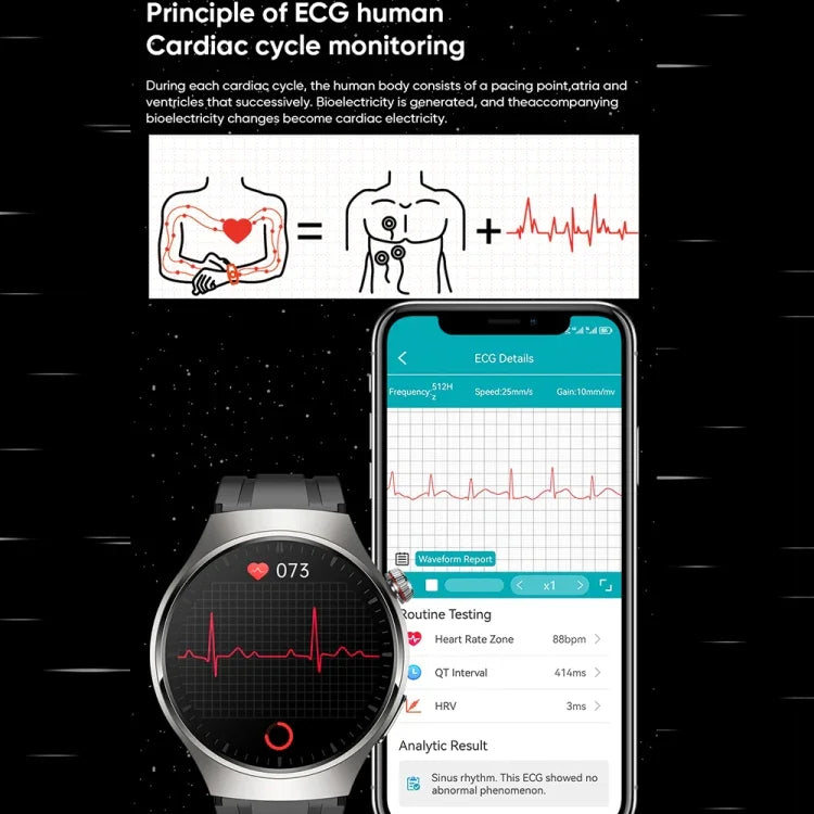 MT200 1.43インチ AMOLED IP67 スマートコールウォッチ, ECG/体温/血糖値モニタリング対応