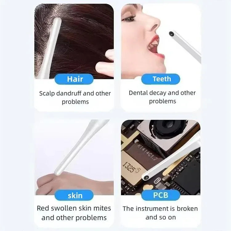 FY-B800 Visual Oral Observation Instrument Wireless WiFi HD Oral Endoscope