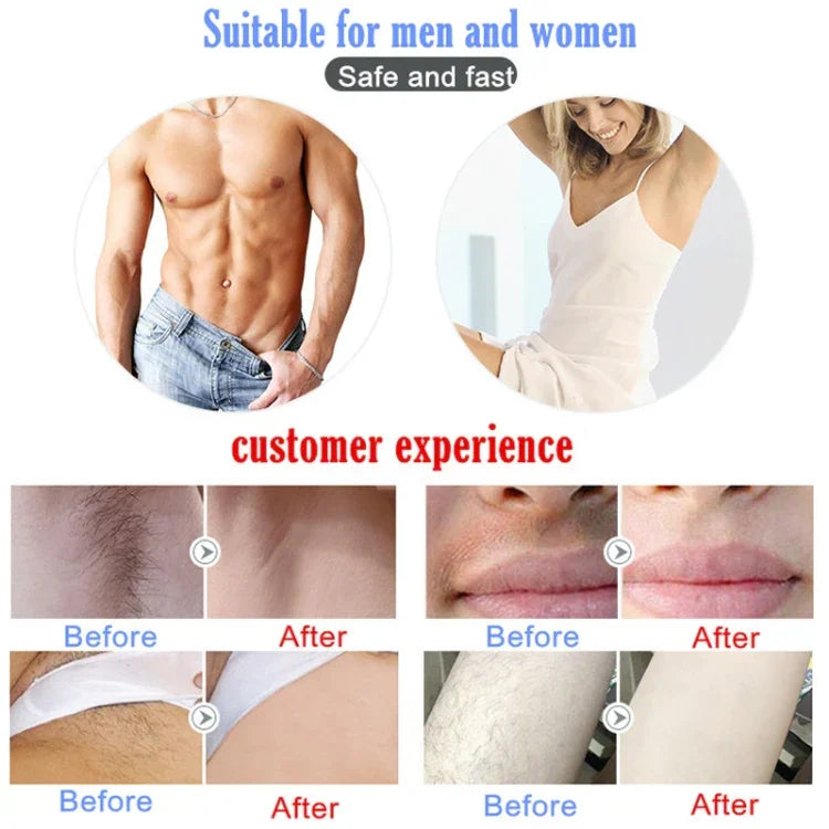 美容家庭用IPL無痛レーザー脱毛器 男女兼用