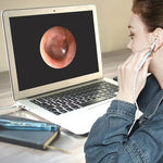 i95 3イン1 USBイヤースコープ検査 HD 0.3MPカメラ付き視覚耳かき OTG対応 Androidスマホ＆PC＆MacBook用、ケーブル長1.75m、3イン1 ホワイト 0.3MP