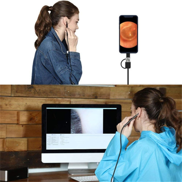 3-in-1 USB HDデジタル検査耳鏡タイプデジタル内視鏡耳垢除去用