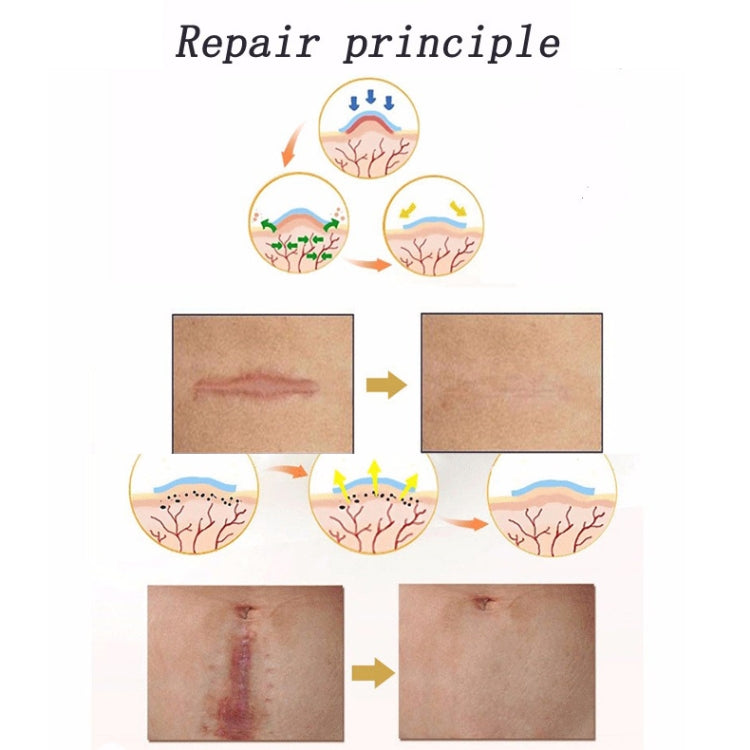 画像代替テキスト