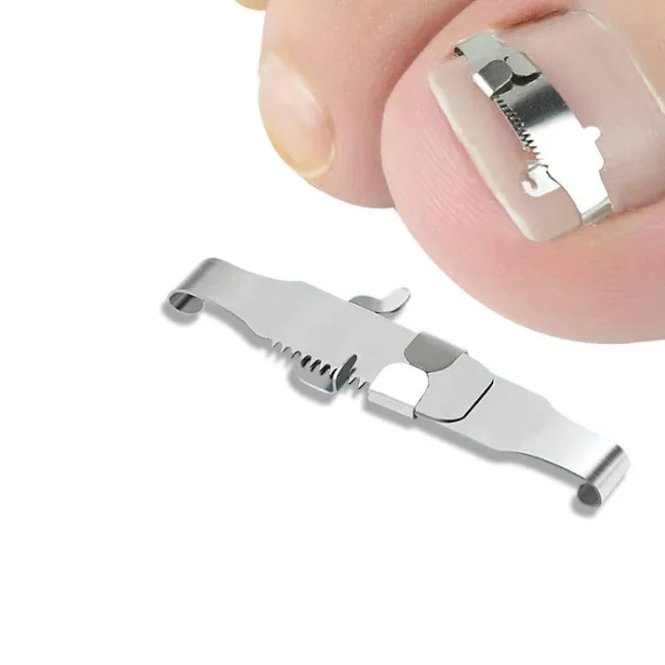 整形外科用バックル付き足の爪溝 巻き爪矯正器具, No. 36 ポジティブネイルバックル, No. 38 ポジティブネイルバックル, No. 40 ポジティブネイルバックル, No. 42 ポジティブネイルバックル, No. 44 ポジティブネイルバックル, No. 36 セット, No. 38 セット, No. 40 セット, No. 42 セット